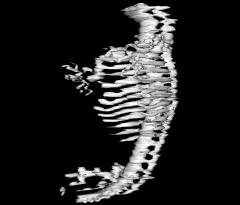Skeleton