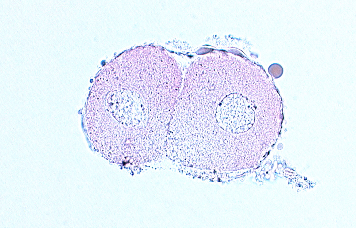 blastomere cytoplasm, blastomere nucleus, cleavage plane, zona pellucida