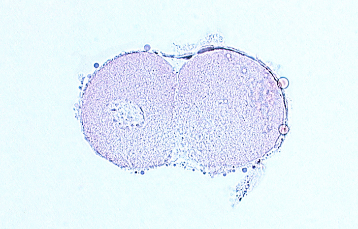 blastomere cytoplasm, edge of blastomere nucleus, subzonal space, zona pellucida
