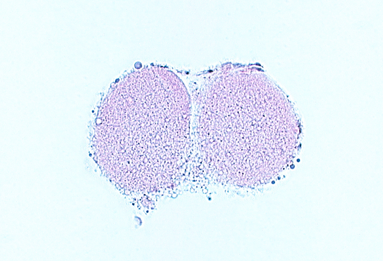 blastomere cytoplasm, cleavage plane, polar body, zona pellucida