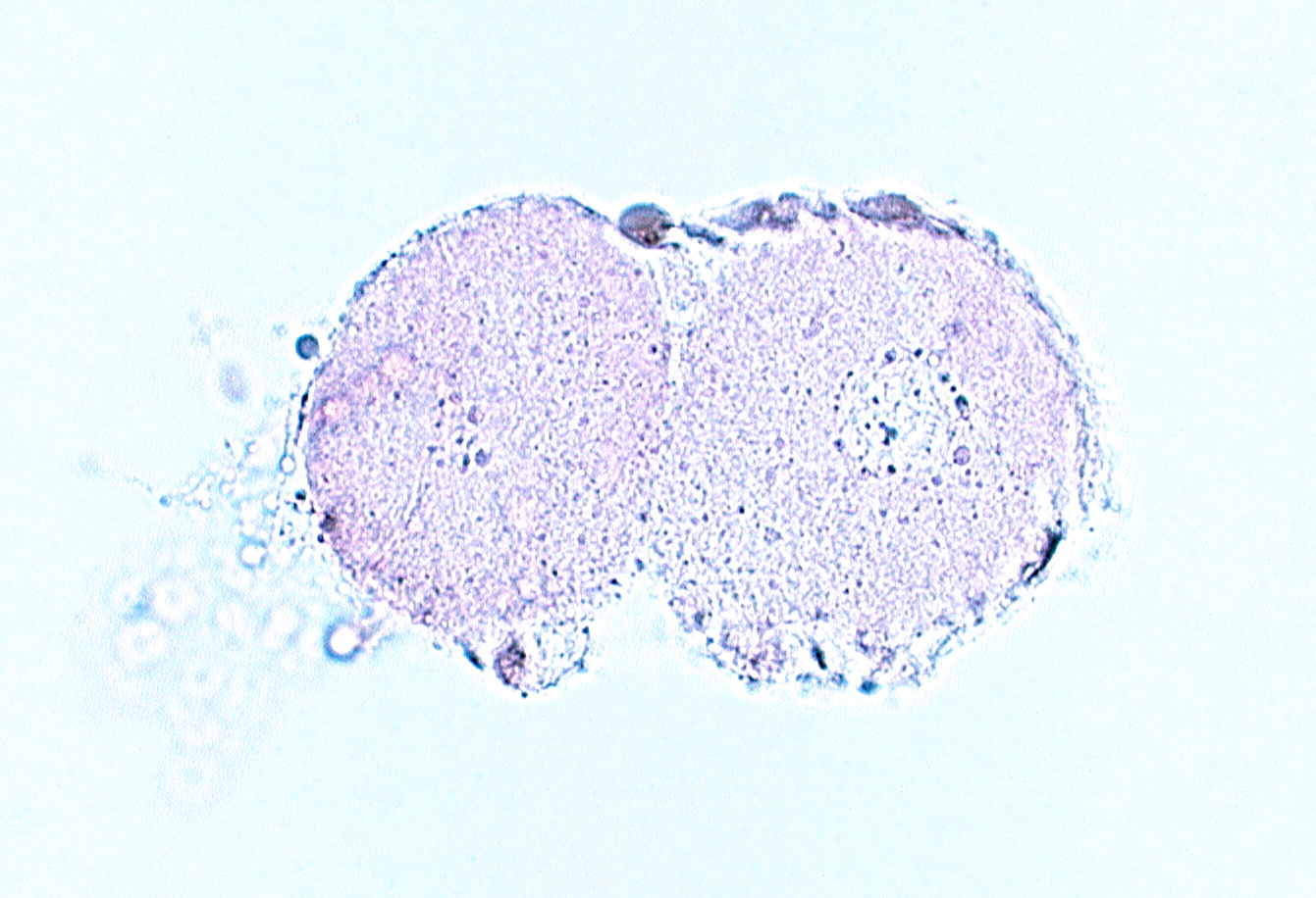 blastomere cytoplasm, cytoplasmic and nuclear material between blastomeres and zona pellucida, edge of blastomere nucleus, polar body, zona pellucida