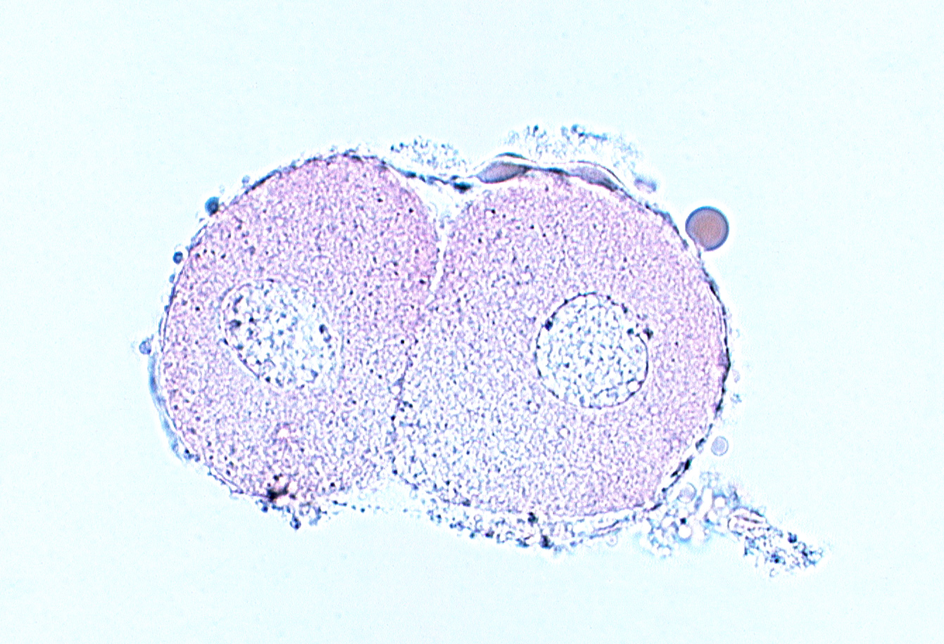 blastomere cytoplasm, blastomere nucleus, cleavage plane, zona pellucida