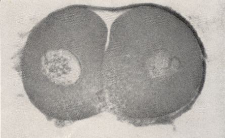 Serial section showing additional nuclear detail