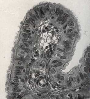 The mucosa of the normal Fallopian tube
