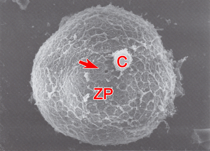 One corona cell attached to the zona pellucida