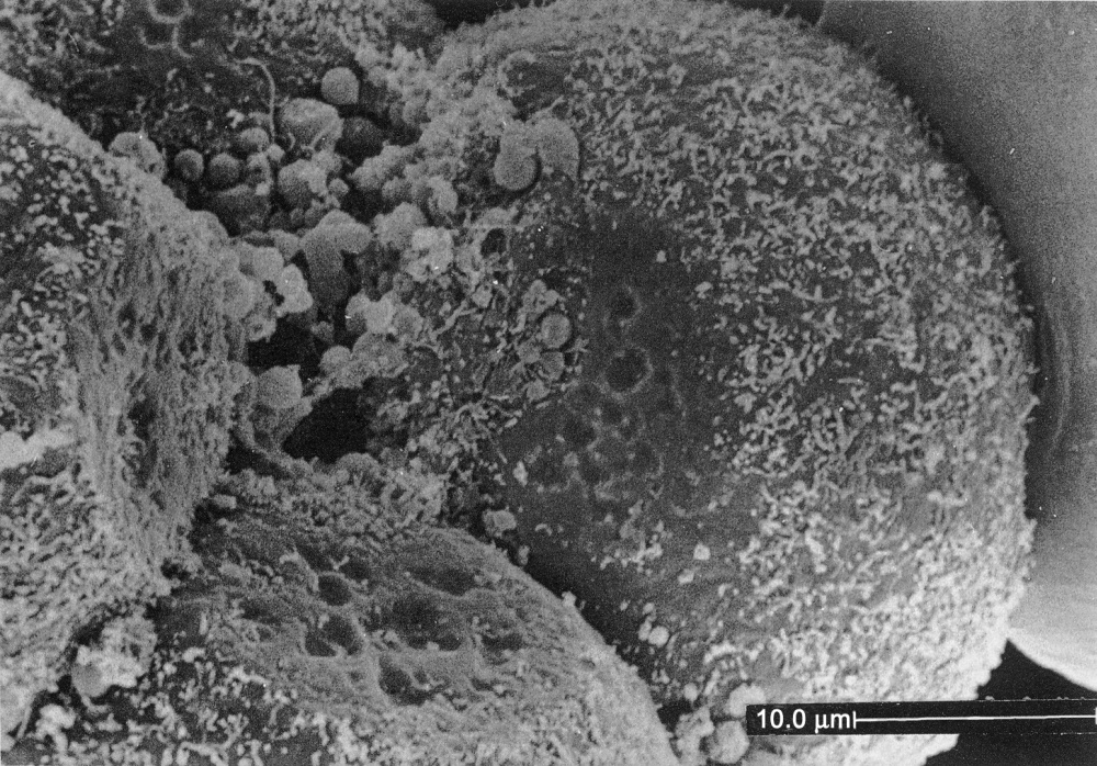 Contact area between blastomeres of a 12-cell embryo