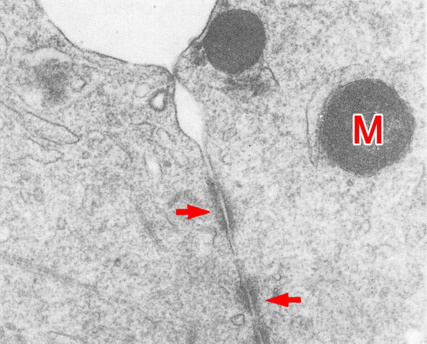 Two rudimentary desmosomes in a 2-cell embryo