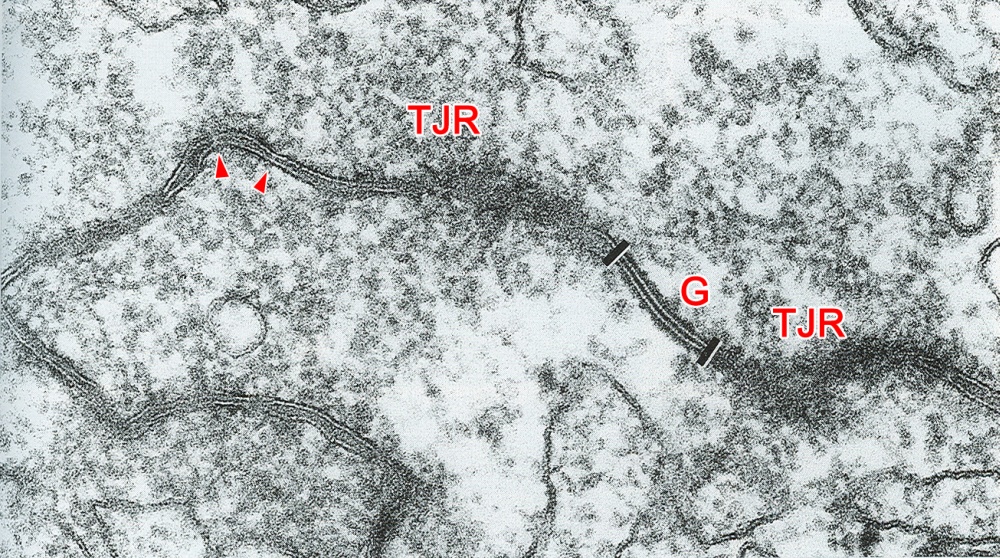 Adjacent surfaces of a polar and an apolar cell in a morula