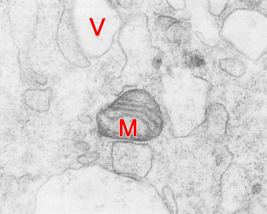 Detail of mitochondrion in a 7-cell embryo