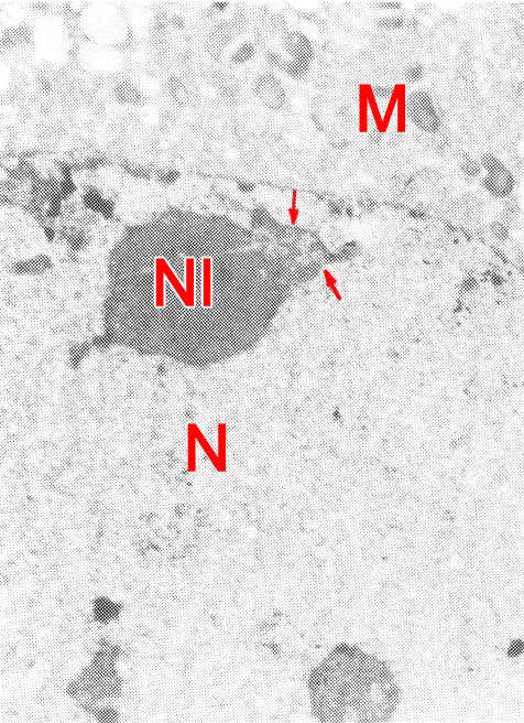 Beginning of differentiation of the nucleolus in a 7-cell embryo