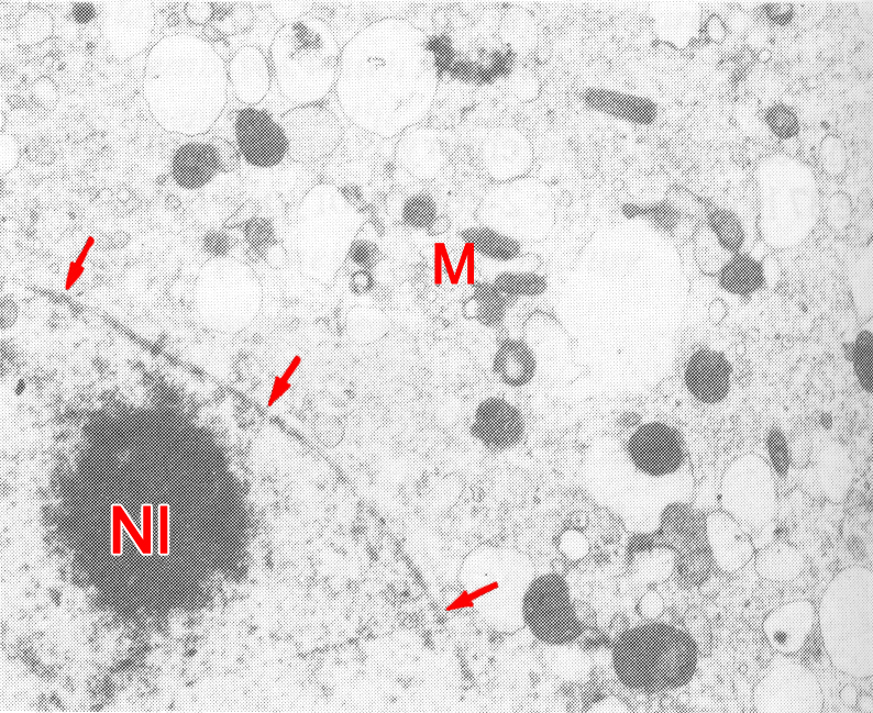 Blebbing absence of the nuclear membrane of a 16-cell embryo