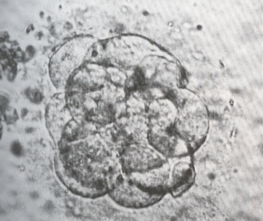 Morula at the beginning of compaction