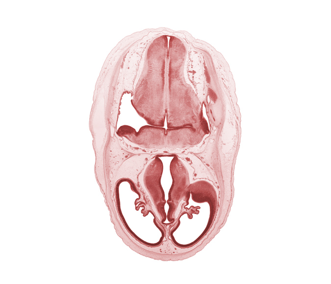 artifact separation(s), basilar artery, cerebral vesicle (telencephalon), choroid fissure, choroid plexus, dural band for tentorium cerebelli, hypothalamic sulcus, hypothalamus, lateral ventricle, marginal ridge, obex, oculomotor nerve (CN III), osteogenic layer, pons region (metencephalon), posterior dural venous plexus, primordial sigmoid sinus, venous plexus(es), ventral thalamus