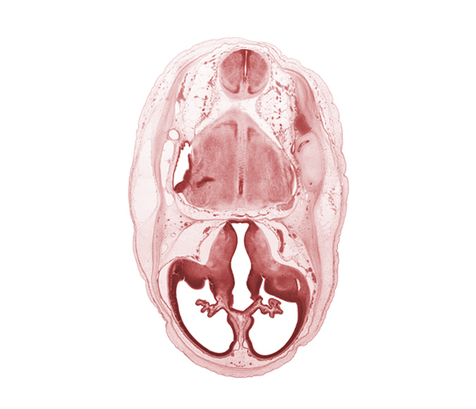 artifact separation(s), central canal, choroid fissure, choroid plexus, dural band for tentorium cerebelli, endolymphatic sac, falx cerebri region, hypothalamus, junction of internal carotid and posterior communicating arteries, lateral recess of rhombencoel (fourth ventricle), lateral ventricle, myelencephalon (medulla oblongata), pyramidal tract region, region of cervical flexure, spinal tract of trigeminal nerve (CN V), sulcus terminalis, third ventricle