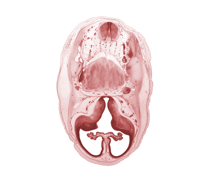 accessory nerve (CN XI), artifact separation(s), basilar artery, choroid fissure, choroid plexus, falx cerebri region, hypothalamic sulcus, hypothalamus, intermediate zone, interventricular foramen, lateral ventricular eminence (telencephalon), marginal zone, medial ventricular eminence (diencephalon), myelencephalon (medulla oblongata), pons region (metencephalon), pyramidal tract region, root of accessory nerve (CN XI), root of glossopharyngeal nerve (CN IX), root of vestibulocochlear nerve (CN VIII), superior ganglion of vagus nerve (CN X), trigeminal nerve (CN V), ventricular zone