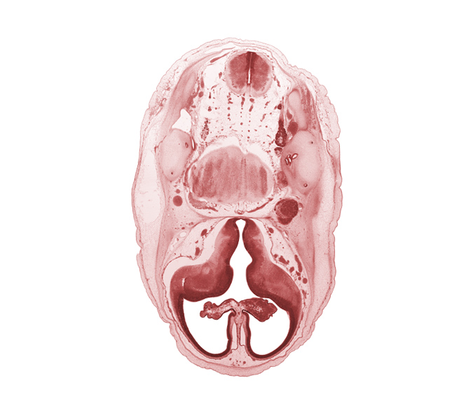 accessory nerve (CN XI), artifact separation(s), basilar artery, central canal, cerebral vesicle (telencephalon), choroid fissure, choroid plexus, hypothalamic sulcus, hypothalamus, internal carotid artery, interventricular foramen, lateral ventricle, lateral ventricular eminence (telencephalon), medial ventricular eminence (diencephalon), motor root of trigeminal nerve (CN V), myelencephalon (medulla oblongata), pyramidal tract region, root of facial nerve (CN VII), semicircular duct, superior ganglion of glossopharyngeal nerve (CN IX), superior ganglion of vagus nerve (CN X)