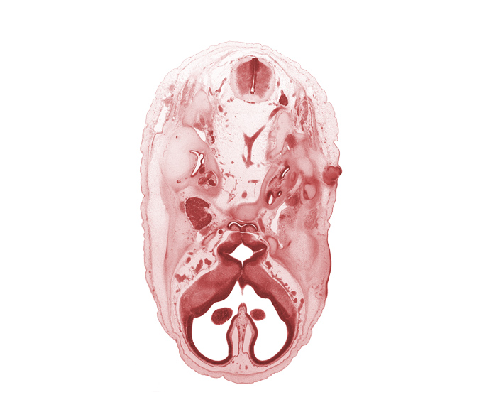 C-1 spinal ganglion, abducens nerve (CN VI), adenohypophysis, anterior cerebral artery, artifact separation(s), basi-occipital (basal plate), basilar artery, central canal, cerebral vesicle (telencephalon), dorsal funiculus, facial nerve (CN VII), hypoglossal nerve (CN XII), interventricular foramen, junction of vertebral arteries, lateral funiculus, lateral ventricle, mandibular nerve (CN V₃), maxillary nerve (CN V₂), medial ventricular eminence (diencephalon), ophthalmic nerve (CN V₁), optic canal, orbitosphenoid, spinal accessory nerve (CN XI), third ventricle, tip of cochlear duct, vagus nerve (CN X), ventral funiculus, vertebral artery