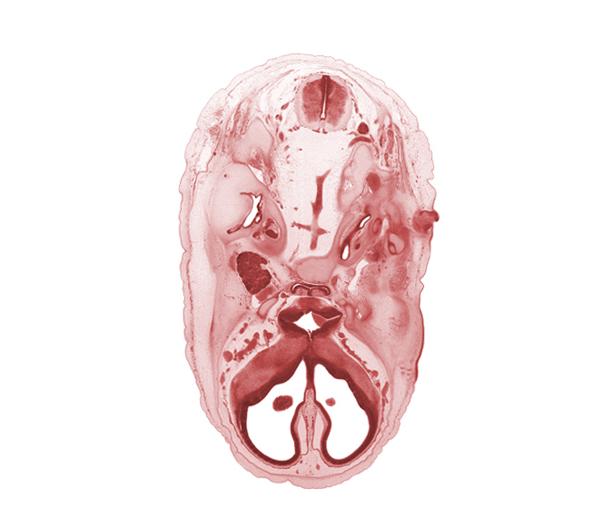 C-1 spinal ganglion, abducens nerve (CN VI), accessory nerve (CN XI), basilar artery, cochlear duct, distal part of adenohypophysis, edge of choroid plexus, falx cerebri region, geniculate ganglion (CN VII), glossopharyngeal nerve (CN IX), grey matter, horizontal part of facial nerve (CN VII), internal carotid artery, internal jugular vein, mandibular nerve (CN V₃), medial ventricular eminence (diencephalon), optic canal, optic chiasma (chiasmatic plate), optic groove, orbitosphenoid, otic capsule, vagus nerve (CN X), vertebral artery, white matter