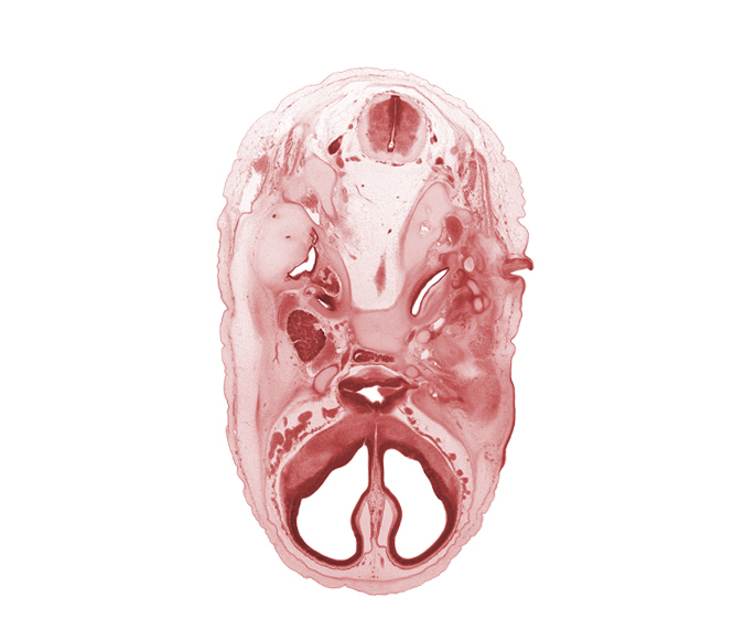 C-1 spinal ganglion, accessory nerve (CN XI), adenohypophysis, artifact separation(s), auricle, basi-occipital (basal plate), cerebral vesicle (telencephalon), cochlear duct, ear ossicle, edge of basilar artery, glossopharyngeal nerve (CN IX), hypoglossal nerve (CN XII), intermediate zone, internal carotid artery, internal jugular vein, lateral ventricle, mandibular nerve (CN V₃), marginal zone, maxillary nerve (CN V₂), ophthalmic nerve (CN V₁), optic canal, optic chiasma (chiasmatic plate), optic nerve (CN II), orbitosphenoid, spinal accessory nerve (CN XI), subarachnoid space, third ventricle, vagus nerve (CN X), ventricular zone