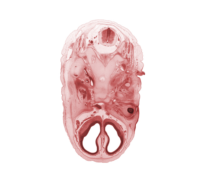 C-2 dorsal root, artifact separation(s), atlanto-occipital joint, basi-occipital (basal plate), blastema of medial rectus muscle, cephalic edge of C-2 spinal ganglion, cephalic edge of dens of C-2 vertebra (axis), cerebral vesicle (telencephalon), cochlear duct, edge of conjunctival sac, edge of cranial cavity, edge of diencephalon, edge of retina, glossopharyngeal nerve (CN IX), hypoglossal canal, lateral ventricle, maxillary vein, neural arch of C-1 vertebra (atlas), occipital condyle, orbitosphenoid, osteogenic layer, otic capsule, subarachnoid space, vagus nerve (CN X), vertebral artery