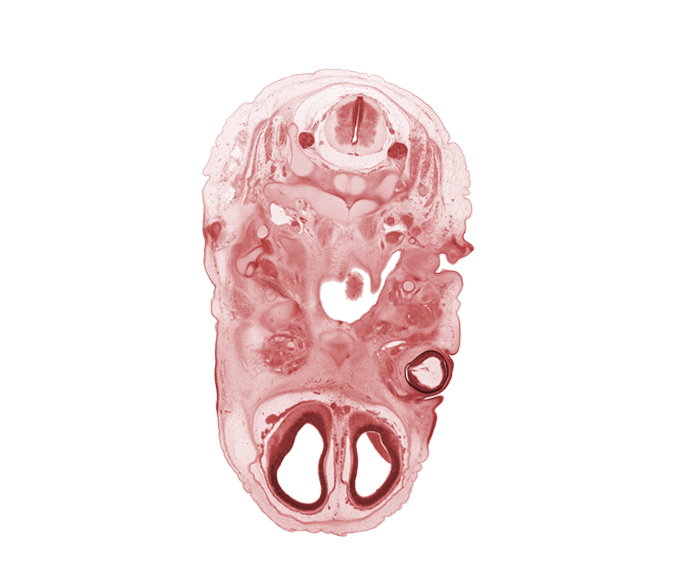 C-2 spinal ganglion, anterior communicating artery, artifact separation(s), basisphenoid, blastema of extra-ocular muscle(s), cerebral vesicle (telencephalon), cornea, dens of C-2 vertebra (axis), edge of tongue, external acoustic meatus, hypoglossal nerve (CN XII), internal carotid artery, internal jugular vein, intraretinal space (optic vesicle cavity), malleus cartilage, nasopharynx, olfactory bulb, optic cup cavity, pharyngotympanic tube, spinal accessory nerve (CN XI), subarachnoid space, vagus nerve (CN X), vertebral artery