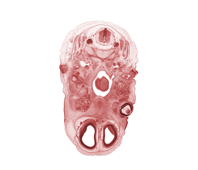 C-2 spinal ganglion, C-2 spinal nerve, C-2 vertebra (axis), accessory nerve (CN XI), artifact separation(s), blastema of extra-ocular muscle(s), blastemata of mastication muscles, edge of lens, foramen cecum of tongue, glossopharyngeal nerve (CN IX), inferior ganglion of vagus nerve (CN X), internal carotid artery, internal jugular vein, nasopharynx, neural layer of retina, olfactory bulb, osteogenic layer, pharyngeal arch 1 cartilage (Meckel), pharyngeal arch 2 cartilage, pigmented layer of retina, subarachnoid space