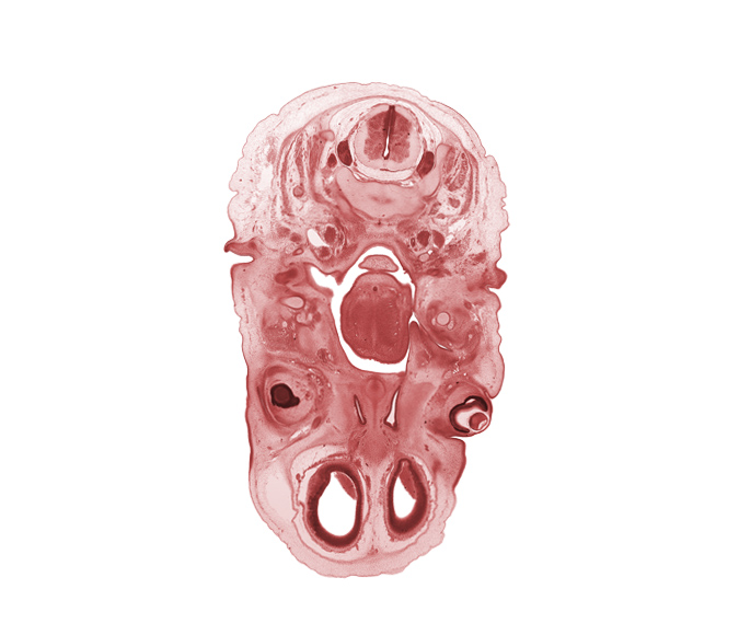 C-3 spinal ganglion, auricle, central canal, cerebral vesicle (telencephalon), ear ossicle, edge of nasal cavity (nasal sac), edge of retina, epiglottis, ethmoid condensation, external acoustic meatus, glossopharyngeal nerve (CN IX), internal jugular vein, intraretinal space (optic vesicle cavity), laryngeal pharynx, lateral ventricle, lens vesicle, nasal cavity (nasal sac), nasopharynx, neural arch of C-2 vertebra (axis), olfactory ventricle, optic cup cavity, pharyngeal arch 1 cartilage (Meckel), subarachnoid space, thyroglossal duct