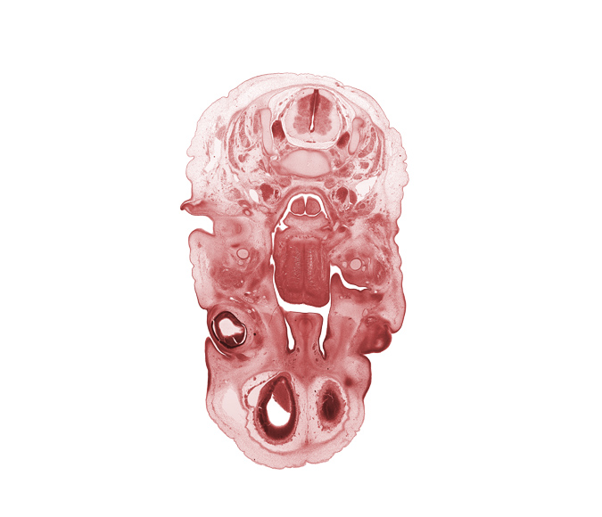 C-3 spinal ganglion, C-3 spinal nerve, auricle, blastema of extra-ocular muscle(s), choana, edge of cerebral vesicle(s), epiglottis, external acoustic meatus, glossopharyngeal nerve (CN IX), inferior ganglion of vagus nerve (CN X), internal jugular vein, lateral ventricle, lingual nerve, middle pharyngeal constrictor muscle, nasal cavity (nasal sac), olfactory bulb, palatine shelf, pharyngeal arch 1 cartilage (Meckel), retropharyngeal space, root of tongue, subarachnoid space