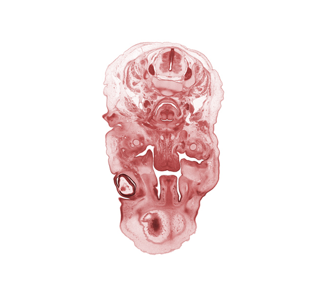 C-3 / C-4 intervertebral disc, C-4 spinal ganglion, blastemata of tongue muscles, body of tongue, edge of cerebral vesicle(s), ethmoid condensation, external acoustic meatus, hypoglossal nerve (CN XII), internal jugular vein, jugular lymph sac, laryngeal pharynx, lingual nerve, loose connective tissue, middle pharyngeal constrictor muscle, palatine shelf, pharyngeal arch 1 cartilage (Meckel), subarachnoid space, submandibular ganglion, superior nasal concha, surface ectoderm, vertebral artery