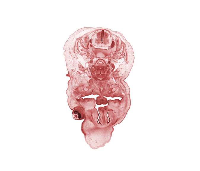 C-5 spinal ganglion, blastema of facial muscle, body of tongue, caudal edge of auricle, central canal, choana, frontal prominence, inferior ganglion of vagus nerve (CN X), internal carotid artery, internal jugular vein, interorbital groove, interorbital ligament, jugular lymph sac, laryngeal condensation, middle cervical sympathetic ganglion, neural arch of C-4 vertebra, palatine shelf, platysma muscle, retropharyngeal space, surface ectoderm