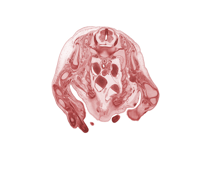 C-8 spinal ganglion, aorta, ascending aorta, blastemata of intercostal muscles, digit 2 (index finger), edge of hand, inferior cervical sympathetic ganglion, left atrium, pericardial cavity, right atrium, scapula, shaft of rib 1, shaft of rib 2, shaft of rib 4, subscapularis muscle, superior vena cava, supraspinatus muscle, teres major muscle, ulnar nerve