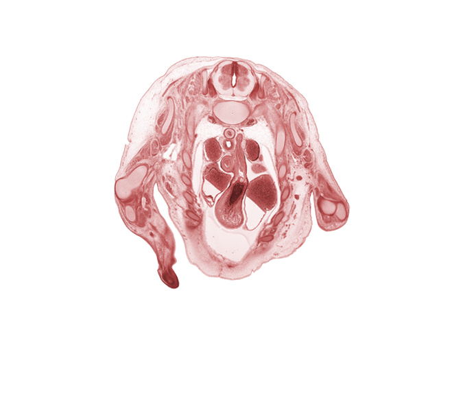 T-1 spinal ganglion, aorta, ascending aorta, caudal segment of left precardinal vein, dorsal horn of grey matter, ductus arteriosus, infundibulum of right ventricle, left atrium, left vagus nerve (CN X), pulmonary trunk, rib 10, rib 2, rib 8, right atrium, right vagus nerve (CN X), right ventricle, superior vena cava, ulna, ventral horn of grey matter