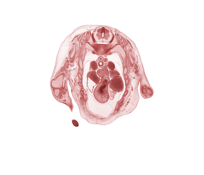T-1 spinal ganglion, ascending aorta, head of rib 2, infundibulum of right ventricle, left vagus nerve (CN X), pulmonary semilunar valve, pulmonary trunk, rhomboid muscle, rib 3, right atrium, right vagus nerve (CN X), scapula, subscapularis muscle, sympathetic trunk, trabecular part of right ventricle, ulnar nerve