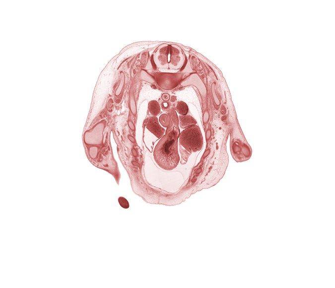 T-1 spinal ganglion, ascending aorta, head of rib 2, infundibulum of right ventricle, left vagus nerve (CN X), pulmonary semilunar valve, pulmonary trunk, rhomboid muscle, rib 3, right atrium, right vagus nerve (CN X), scapula, subscapularis muscle, sympathetic trunk, trabecular part of right ventricle, ulnar nerve