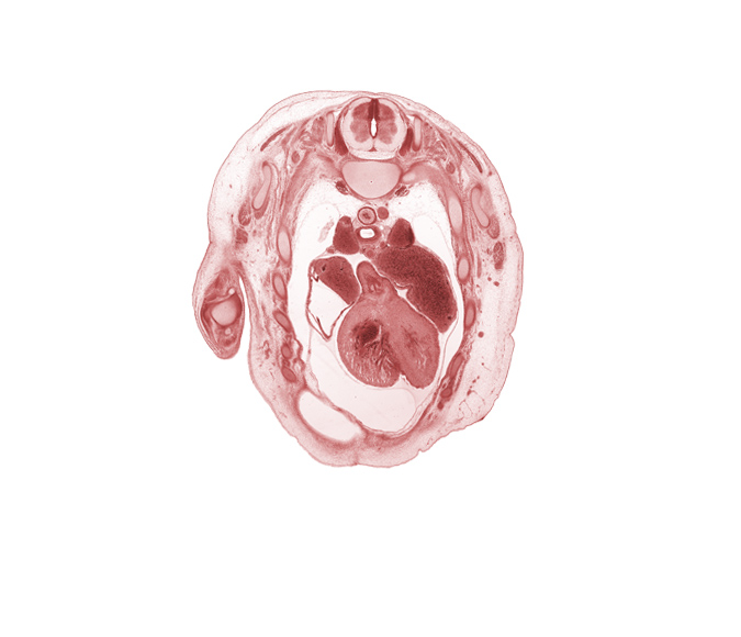 T-2 spinal ganglion, T-2 spinal nerve, anterior interventricular sulcus, aortic semilunar valve, apex of right lung, arch of azygos vein, edge of peritoneal cavity, left atrium, left ventricle, pericardial cavity, rib 3, right atrium, right ventricle, superior vena cava, teres major muscle, trachea, transverse pericardial sinus, trapezius muscle