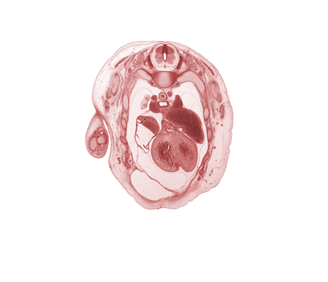 T-2 spinal ganglion, anterior interventricular sulcus, anterior spinal artery, aorta, aortic semilunar valve, azygos vein, caudal segment of left precardinal vein, central tendon of diaphragm, head of rib 3, left atrium, musculi pectinati in wall of right auricle, neural arch, peritoneal cavity, phrenic nerve, rib 4, subarachnoid space, superior vena cava, trabecular part of left ventricle, trabecular part of right ventricle, tracheal bifurcation, trapezius muscle, upper lobe of right lung