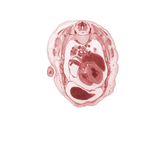 T-3 spinal ganglion, T-3 spinal nerve, aorta, apex of upper lobe of left lung, auricle of right atrium, central tendon of diaphragm, interventricular foramen, interventricular septum, latissimus dorsi muscle, left atrium, left horn of sinus venosus, left vagus nerve (CN X), primary bronchus, pulmogenic coat, rib 4, rib 6, rib 7, right lobe of liver, right vagus nerve (CN X), superior vena cava, upper lobe of right lung