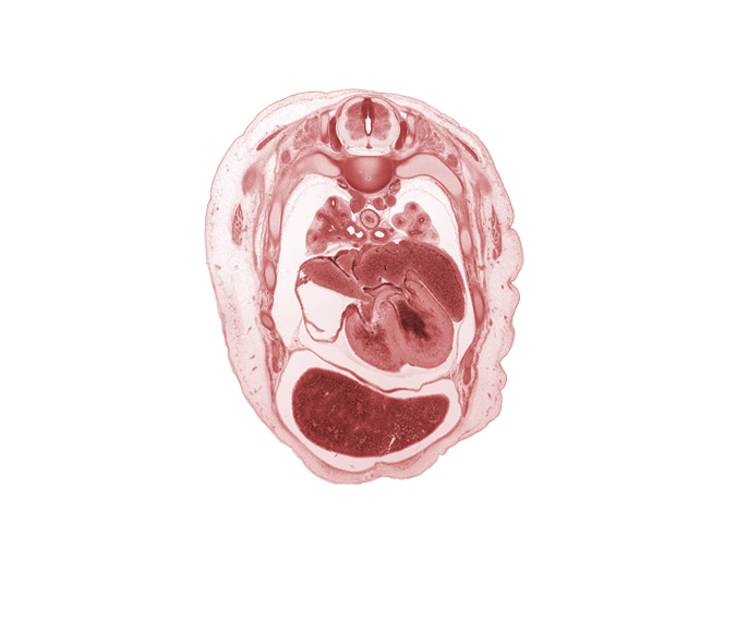 T-3 spinal ganglion, apex of heart, apical segmental bronchus, head of rib 4, latissimus dorsi muscle, left atrioventricular canal, left atrium, left venous valve, left ventricle, primary bronchus, pulmogenic coat, rib 5, right atrioventricular canal, right atrium, right venous valve, right ventricle, sinus venosus, superior hemi-azygos vein, trapezius muscle, upper lobe of left lung, upper secondary bronchus