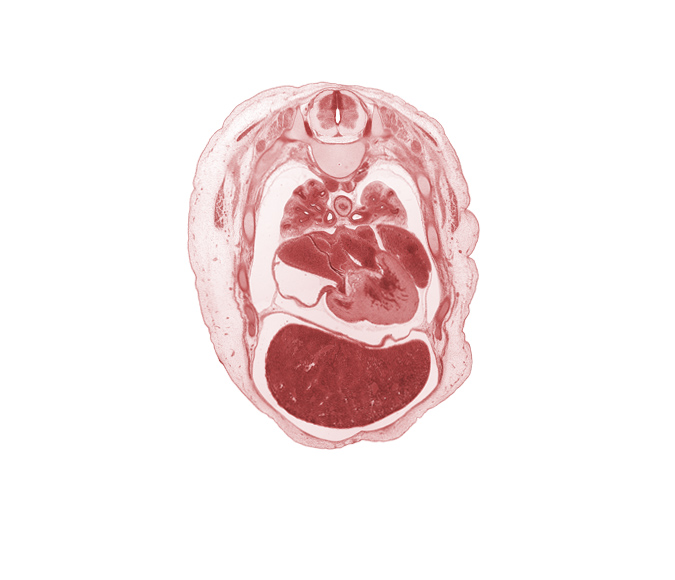 T-4 spinal ganglion, T-4 spinal nerve, aorta, dorsal horn of grey matter, esophagus, lateral horn of grey matter, left atrium, left lobe of liver, left posterior intercostal artery, left ventricle, pericardial cavity, pericardial sac, peritoneal cavity, pleural cavity, primary bronchus, pulmogenic coat, rib 5, rib 6, rib 7, right atrium, right lobe of liver, upper lobe of left lung, upper lobe of right lung, ventral horn of grey matter