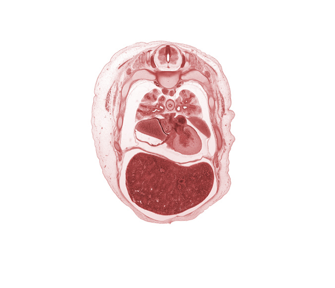 T-4 spinal ganglion, central canal, costovertebral joint, horizontal fissure, left atrium, left pulmonary vein, left ventricle, lower secondary bronchus, medial segmental bronchus, middle lobe of right lung, middle secondary bronchus, muscular layer of esophagus, oblique fissure, pericardial cavity, peritoneal cavity, phrenic nerve, rib 5, rib 6, rib 7, right pulmonary vein, upper lobe of left lung, upper lobe of right lung