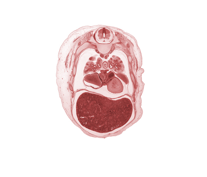 T-4 / T-5 interganglion region, diaphragm, horizontal fissure, lateral segmental bronchus, left lobe of liver, left ventricle, lower lobe of right lung, lower secondary bronchus, medial segmental bronchus, middle lobe of right lung, oblique fissure, pericardial sac, rib 6, rib 7, right atrium, right lobe of liver, right pulmonary vein, upper lobe of left lung, upper lobe of right lung