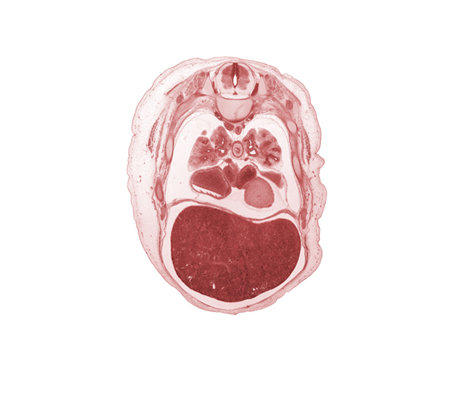 T-5 spinal ganglion, T-5 spinal nerve, azygos vein, caudal edge of upper lobe of right lung, central canal, diaphragm, esophagus endoderm, junction of inferior vena cava and right atrium, left atrium, left lobe of liver, lower lobe of left lung, lower secondary bronchus, oblique fissure, pericardial cavity, peritoneal cavity, pleural cavity, rib 6, rib 7, right lobe of liver, superior segmental bronchus, sympathetic trunk, upper lobe of left lung