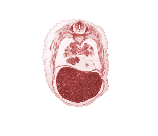 T-5 spinal ganglion, bare area of liver, caudal edge of left ventricle, dorsal funiculus, head of rib 6, inferior vena cava, lateral funiculus, left lobe of liver, lower lobe of left lung, lower lobe of right lung, middle lobe of right lung, oblique fissure, pericardial cavity, pericardial sac, rectus abdominis muscle, rib 7, right atrium, right lobe of liver, subarachnoid space, sympathetic trunk, upper lobe of left lung, ventral funiculus