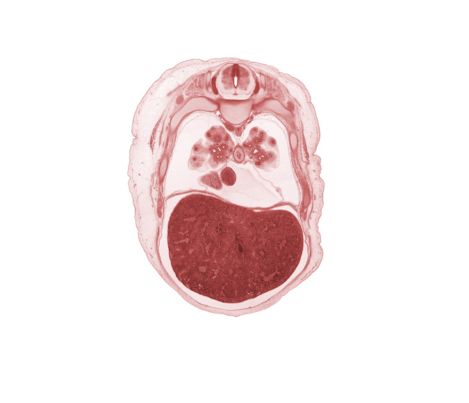 T-5 spinal ganglion, anterior basal segmental bronchus, aorta, azygos vein, diaphragm, dorsal horn of grey matter, edge of right atrium, external intercostal muscle(s), head of rib 6, inferior vena cava, lateral horn of grey matter, left lobe of liver, liver prominence, medial basal segmental bronchus, neural arch, oblique fissure, pericardial cavity, peritoneal cavity, rib 7, right lobe of liver, trapezius muscle, ventral horn of grey matter
