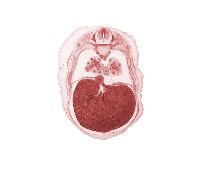 T-6 spinal ganglion, aorta, azygos vein, efferent hepatic vein, iliocostalis muscle, inferior vena cava, junction of hepatic veins and inferior vena cava, left lobe of liver, longissimus muscle, lower lobe of left lung, lower lobe of right lung, muscular layer of esophagus, peritoneal cavity, rib 7, rib 8, spinalis muscle, sympathetic trunk