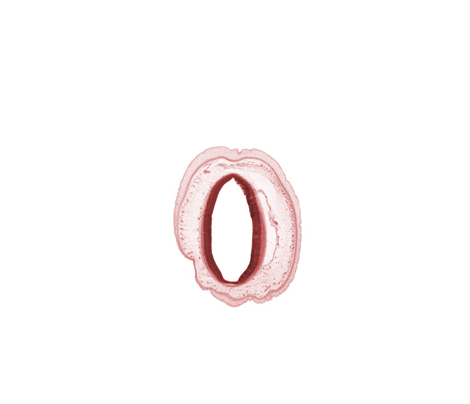 artifact separation(s), cerebral aqueduct (mesocoele), osteogenic layer, roof plate of mesencephalon, subarachnoid space, vascular plexus