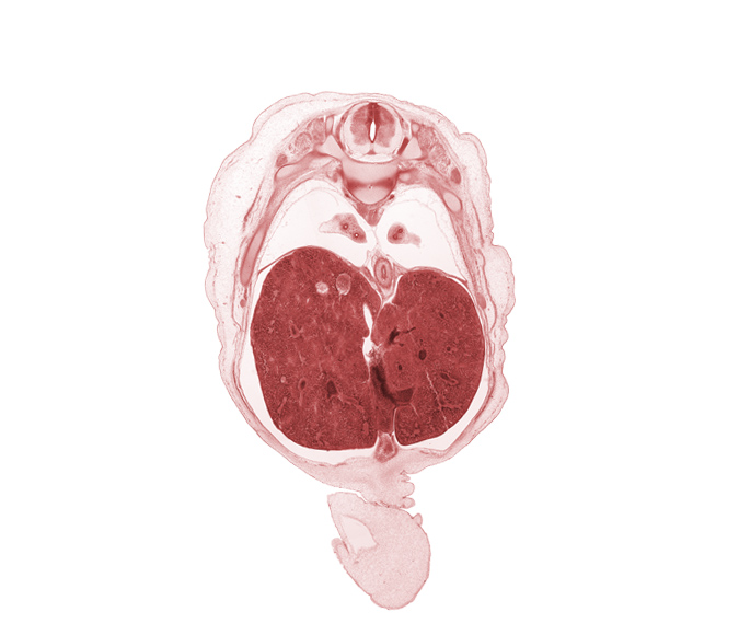 T-9 spinal ganglion, T-9 ventral root, afferent hepatic vein, azygos vein, cephalic edge of umbilical vein, ductus venosus, edge of umbilical coelom, esophageal hiatus, esophagus, grey matter, inferior vena cava (hepatic part), left lobe of liver, lower lobe of left lung, lower lobe of right lung, neural arch, posterior intercostal artery, rib 9, right lobe of liver, white matter