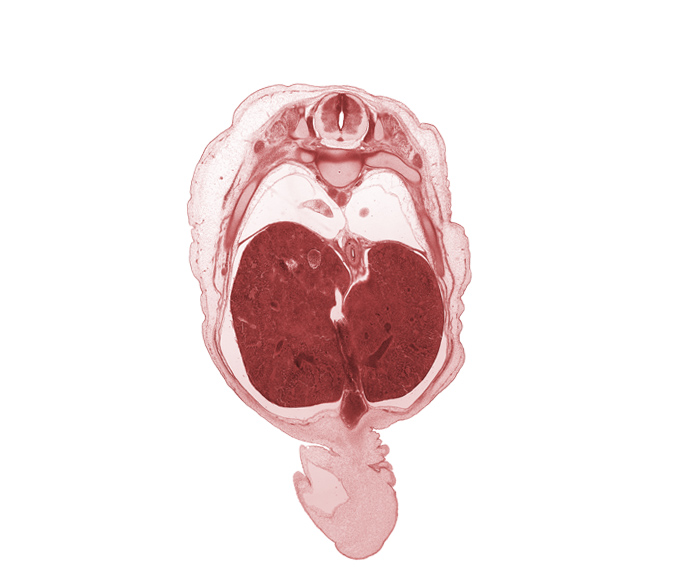 T-9 dorsal root, T-9 spinal ganglion, T-9 spinal nerve, T-9 ventral root, caudal edge of left lung, dorsal horn of grey matter, head of rib 9, inferior vena cava (hepatic part), junction of ductus venosus and hepatic portal vein, junction of ductus venosus and umbilical vein, lateral horn of grey matter, latissimus dorsi muscle, liver prominence, lower lobe of right lung, peritoneal cavity, pleural cavity, rib 10, umbilical coelom, umbilical cord, umbilical vein, ventral horn of grey matter