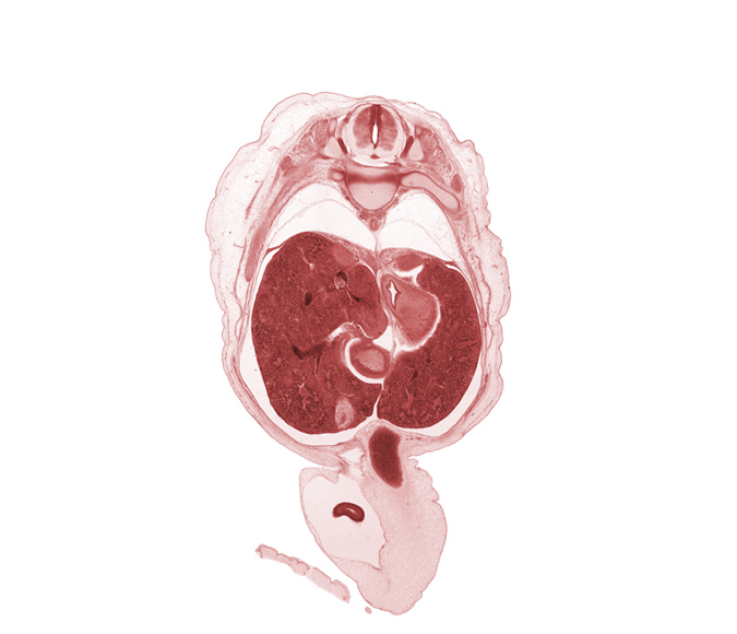 T-10 spinal ganglion, aorta, azygos vein, cardiac portion of stomach, caudate lobe of liver, cephalic edge of suprarenal gland, cephalic edge of suprarenal gland cortex, cystic duct, distal limb of herniated midgut, dorsal horn of grey matter, gall bladder, head of rib 10, hepatic portal vein, inferior hemi-azygos vein, lateral horn of grey matter, left lobe of liver, muscularis of body of stomach, muscularis of pyloric antrum of stomach, right lobe of liver, umbilical vein, ventral horn of grey matter