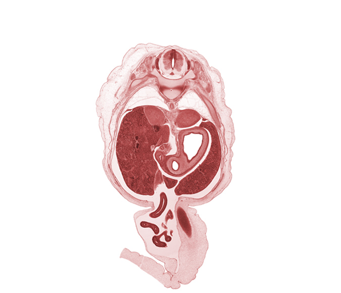 T-10 / T-11 intervertebral disc, T-10 spinal ganglion, T-10 ventral root(s), aorta, distal limb of herniated midgut, junction of common hepatic and cystic ducts, lesser curvature of stomach, mesocolon, notochord, proximal limb of herniated midgut, pyloric antrum of stomach, pyloric sphincter, rib 11, superior part of duodenum (first part), suprarenal gland cortex, testis, umbilical coelom, umbilical vein